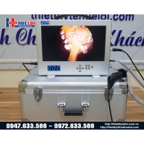 Máy nội soi tai mũi họng 3 trong 1 - NCM 15 Máy nội soi tai mũi họng 3 trong 1 - NCM 15